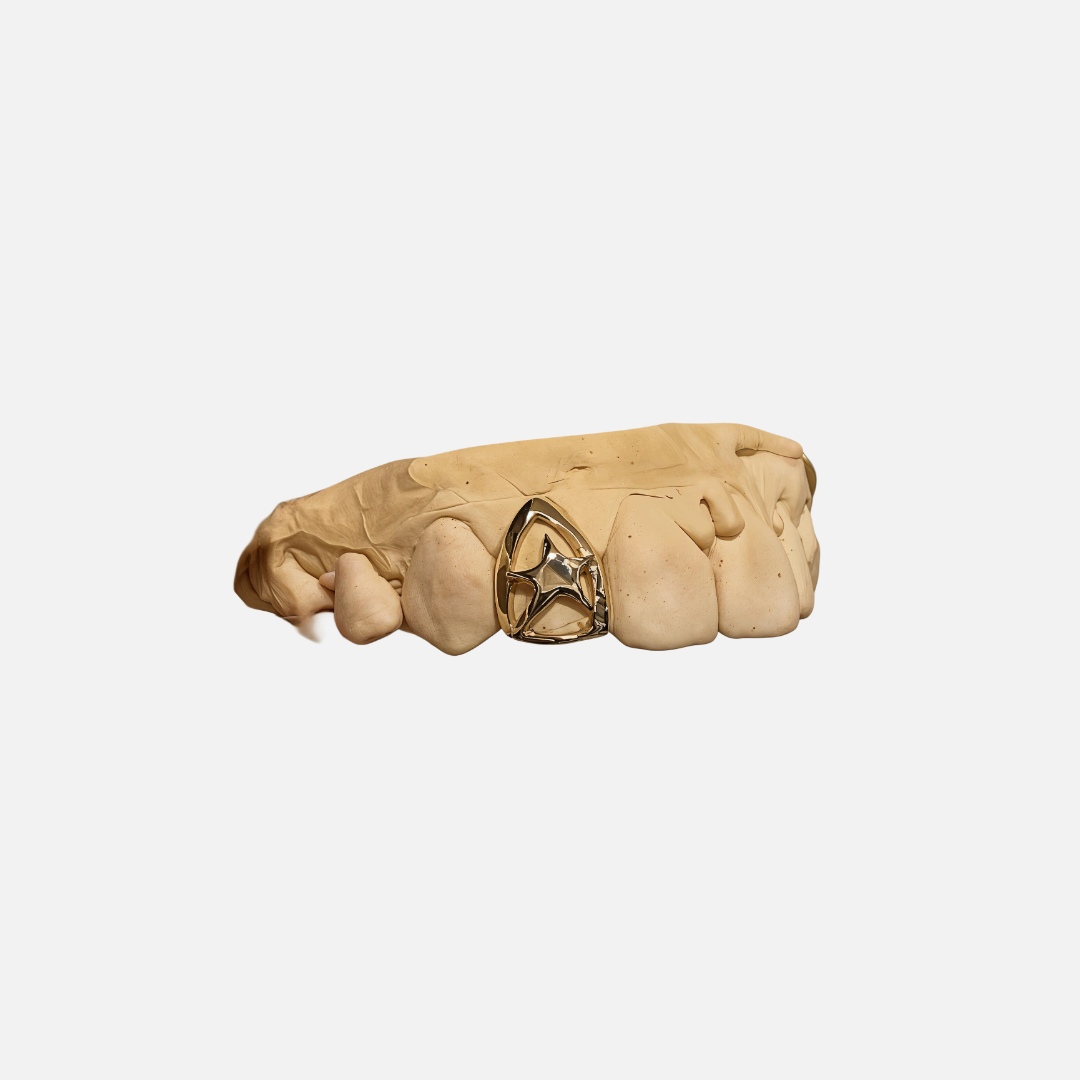 Star grillz